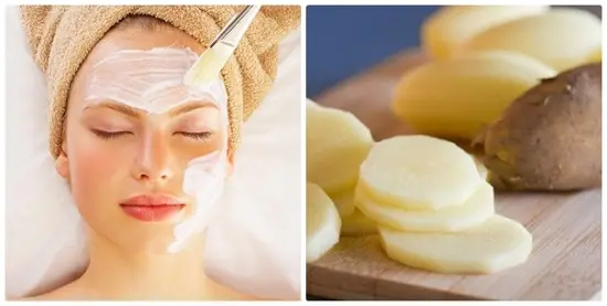 Mách bạn cách trị mụn bằng khoai tây cực hay